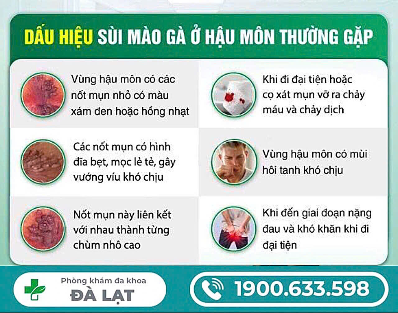 Hình ảnh minh họa